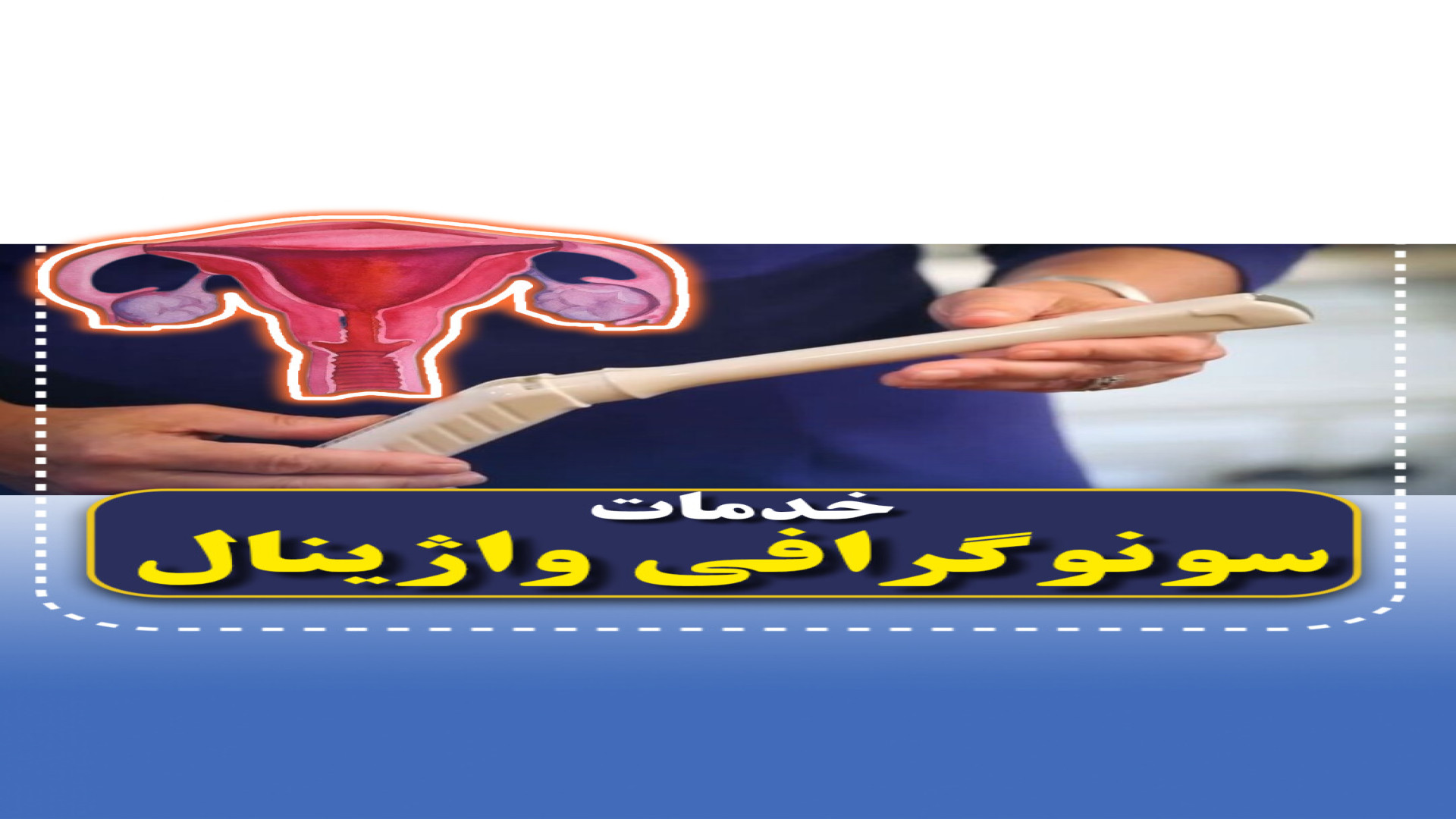 انواع سونوگرافی واژینال و رکتال تخصصی۰۲۱۲۲۹۱۱۳۷۰ مرکز تصویربرداری دکتر مریم ابراهیمی، مبنا-تهران