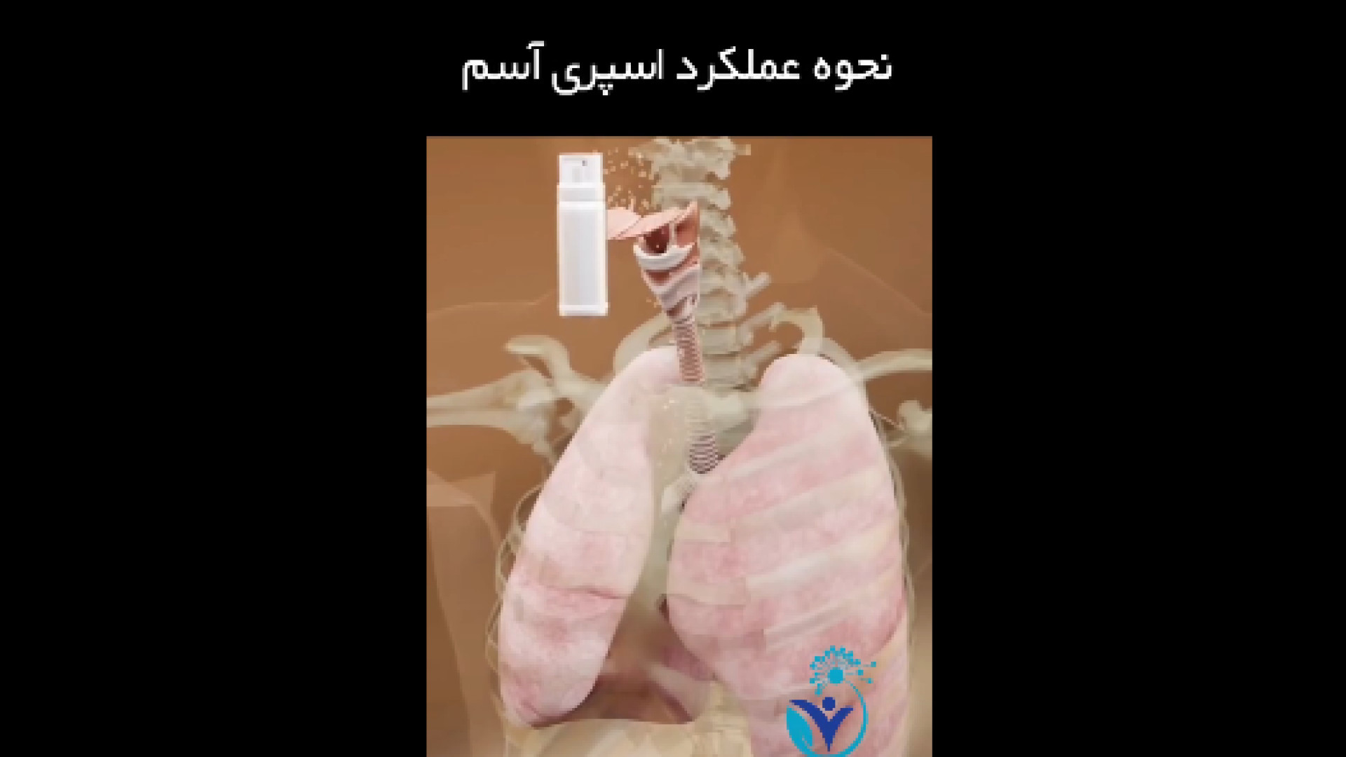 نحوه عملکرد اسپری آســم دکتر شهرام سیدی متخصص آلرژی و ایمونولوژی