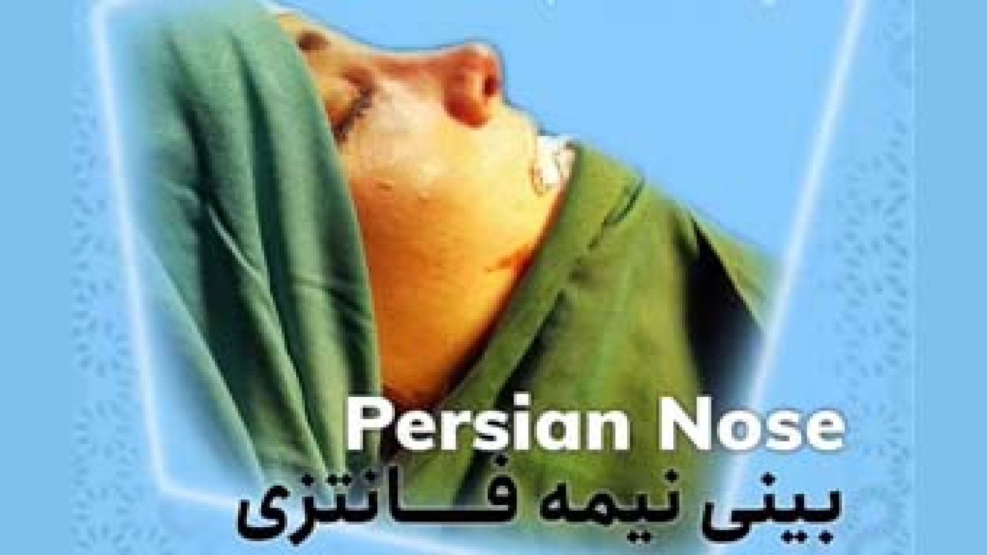 عمل بینی نیمه فانتزی | دکتر آیدین احمدی دهج دکتر آیدین احمدی دهج | جراح پلاستیک