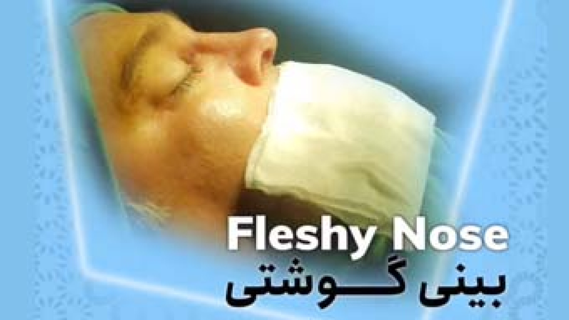 بینی طبیعی و مردانه | دکتر آیدین احمدی دهج دکتر آیدین احمدی دهج | جراح پلاستیک