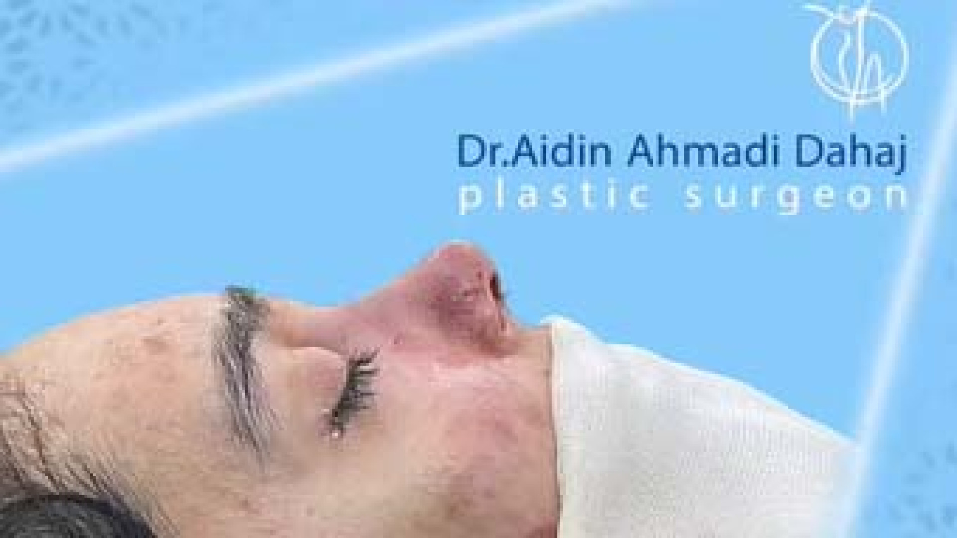 بینی به سبک طبیعی | دکتر آیدین احمدی دهج دکتر آیدین احمدی دهج | جراح پلاستیک