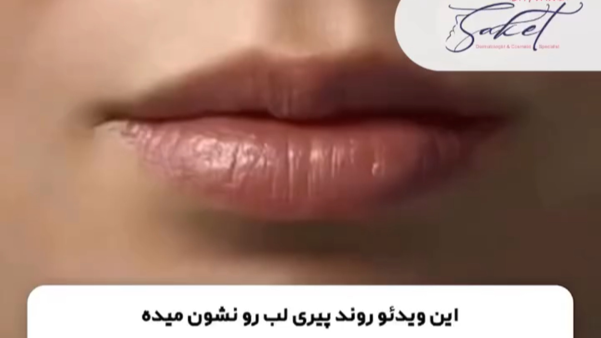 رونــد پیری لب دکتر پروانه ساکت - متخصص پوست و مو، زیبایی