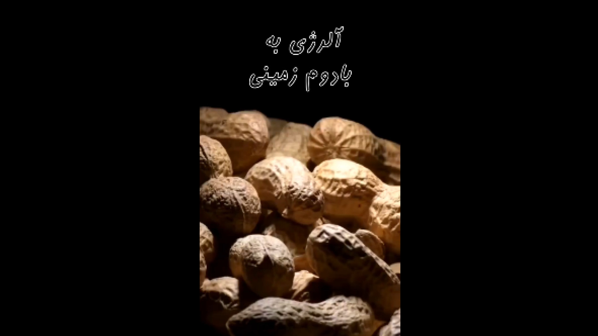 علائم آلرژی به بادوم اندودنتیکس