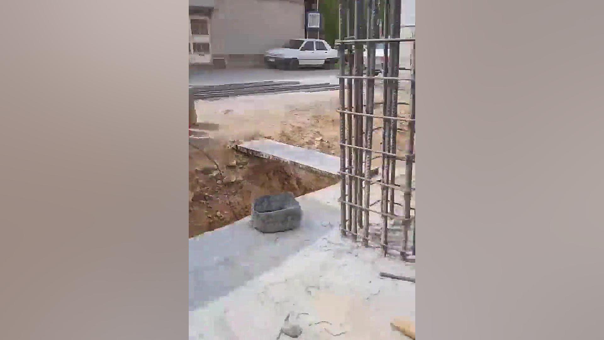الکترود ژمین بیماری هموگلوبین S