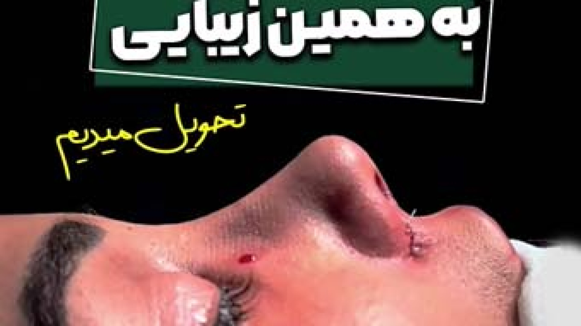 بلافاصله بعد از | دکتر علی باقری حق دکتر علی باقری حق