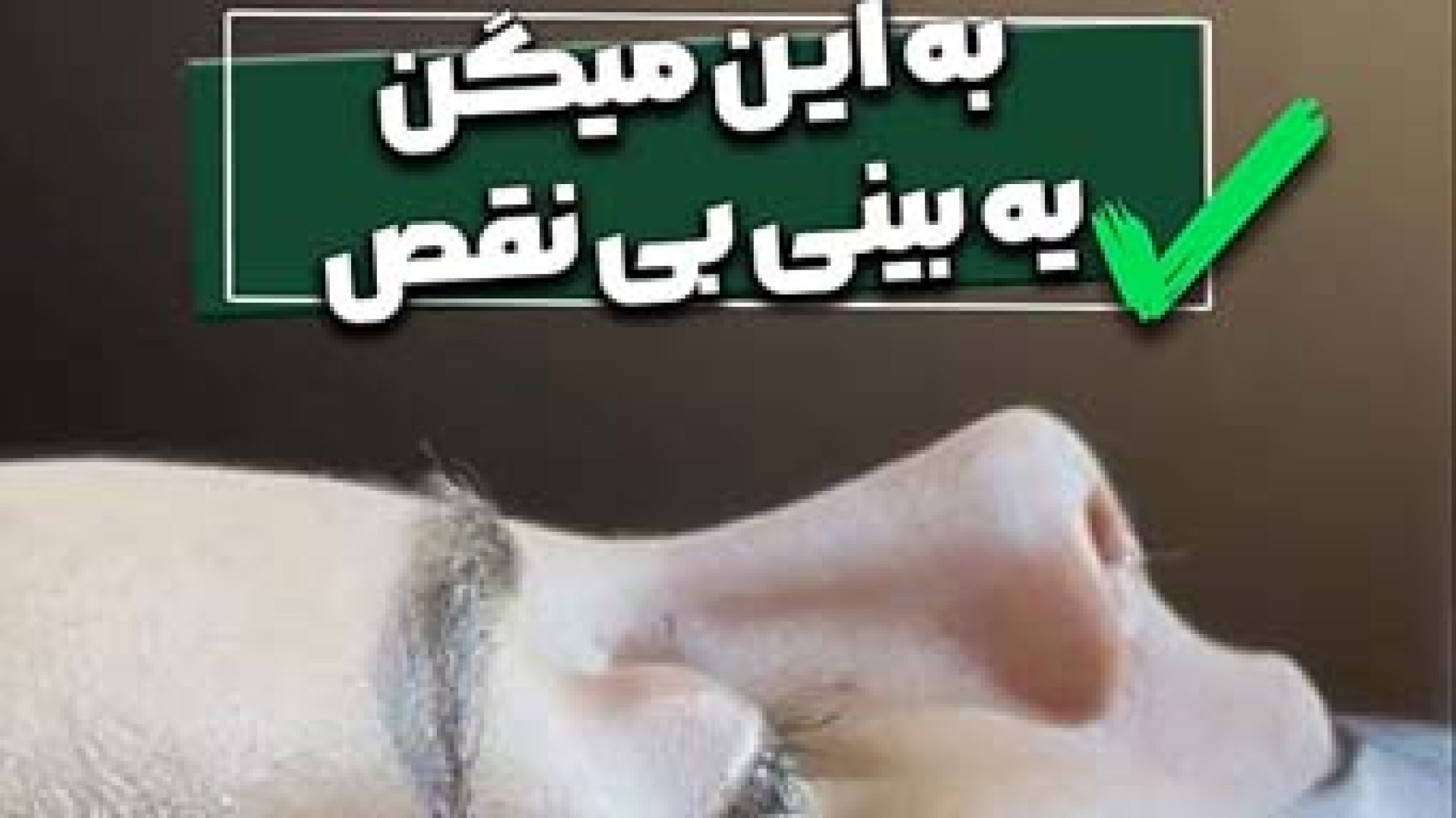 نتیجه فوق العاده جراحی بینی توسط آقای دکتر علی باقری حق دکتر علی باقری حق