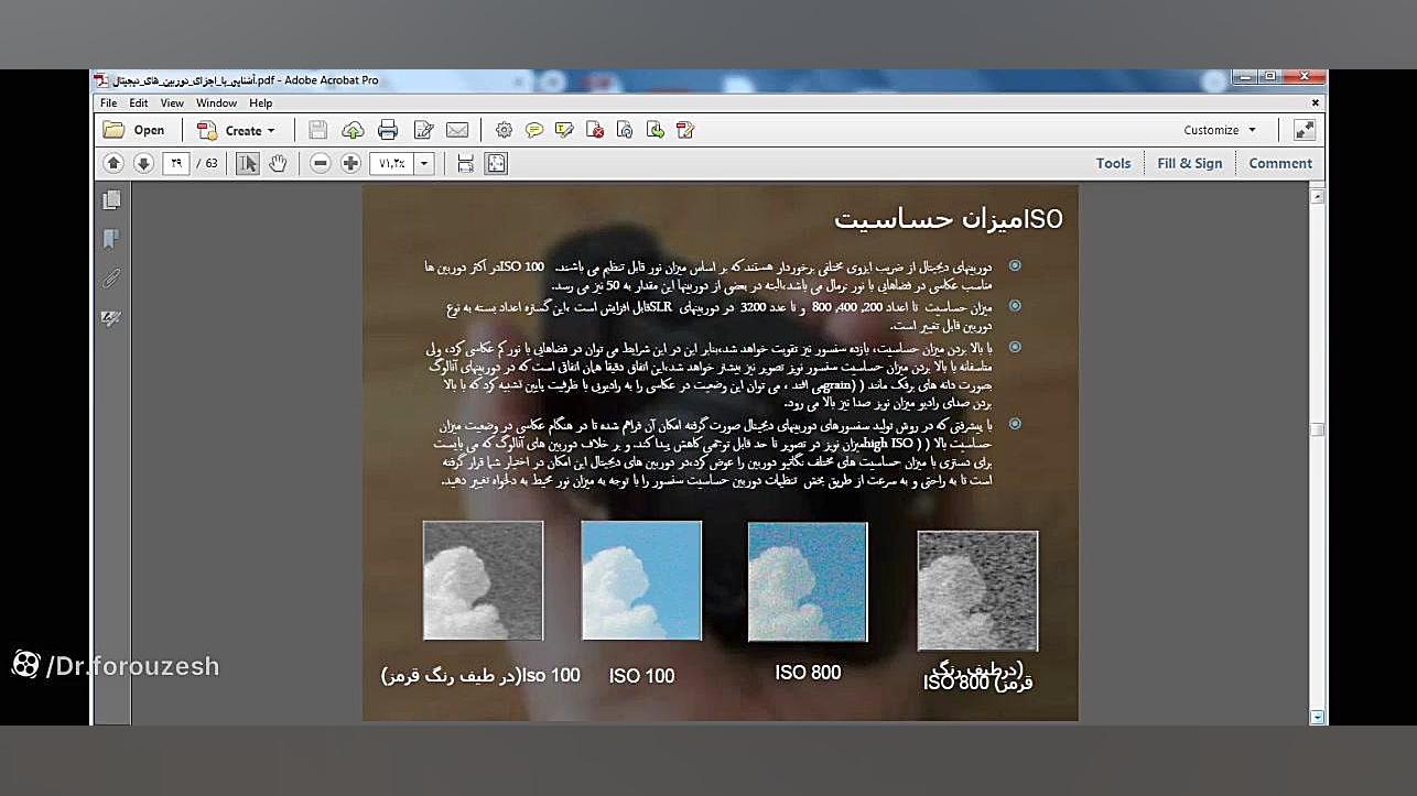 عکاسی- جلسه چهارم- میزان حساسیت- مدرس دکتر سعید فروزش اریتروبلاستوز جنینی