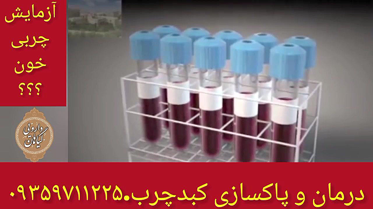 آزمایش در چربی خون درمان و پاکسازی کبدچرب ۰۹۳۵۹۷۱۱۲۲۵ تزریق بوتاکس