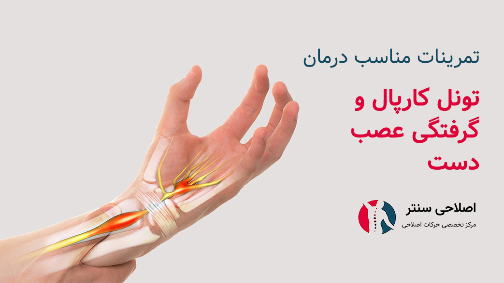 تمرینات مخصوص درمان سندرم تونل کارپال و گرفتگی عصب دست پست جدید