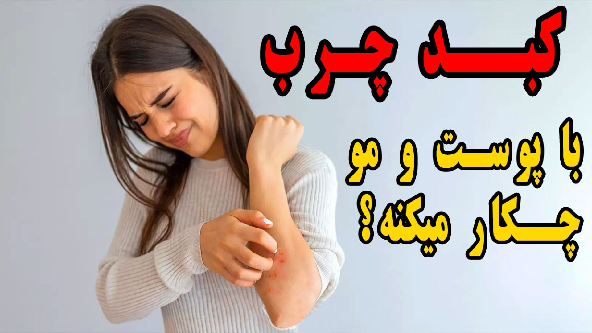 علائم بروز کبد چرب بروی پوست و مو . نشانه های کبد چرب چیست؟ ابرسانی پوست