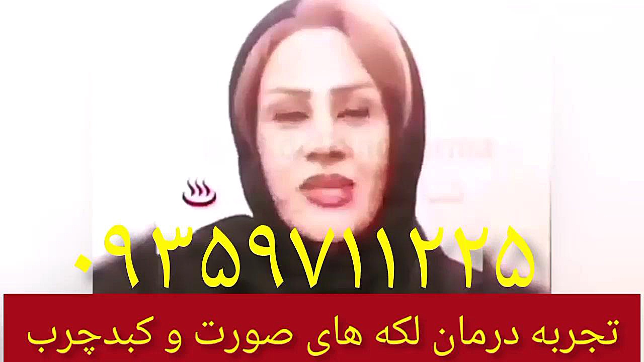 تجربه درمان لکه های پوستی صورت و کبدچرب ۰۹۳۵۹۷۱۱۲۲۵ ترمیم لبخند لثه‌ای