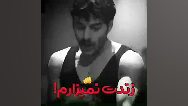 گودال جراحی پف زیر چشم