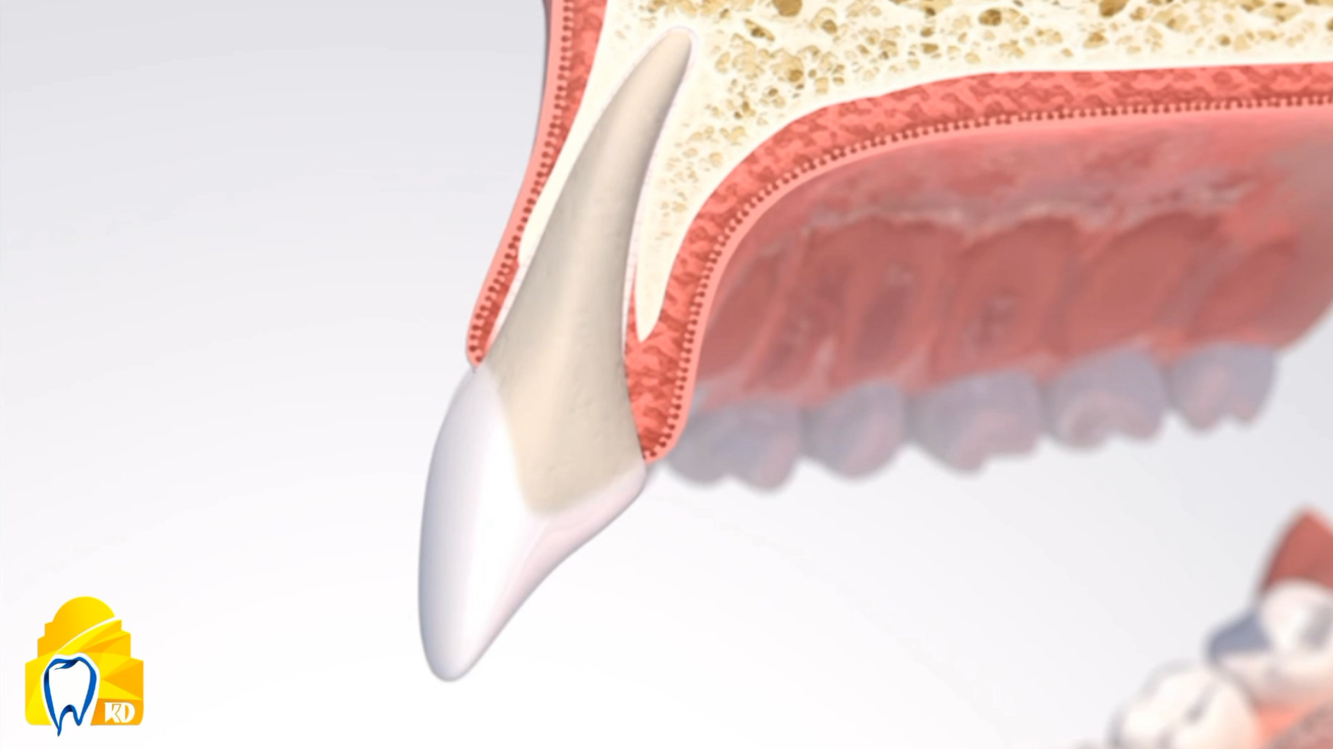 تحلیل استخوان کلینیک دندانپزشکی کارمادنت