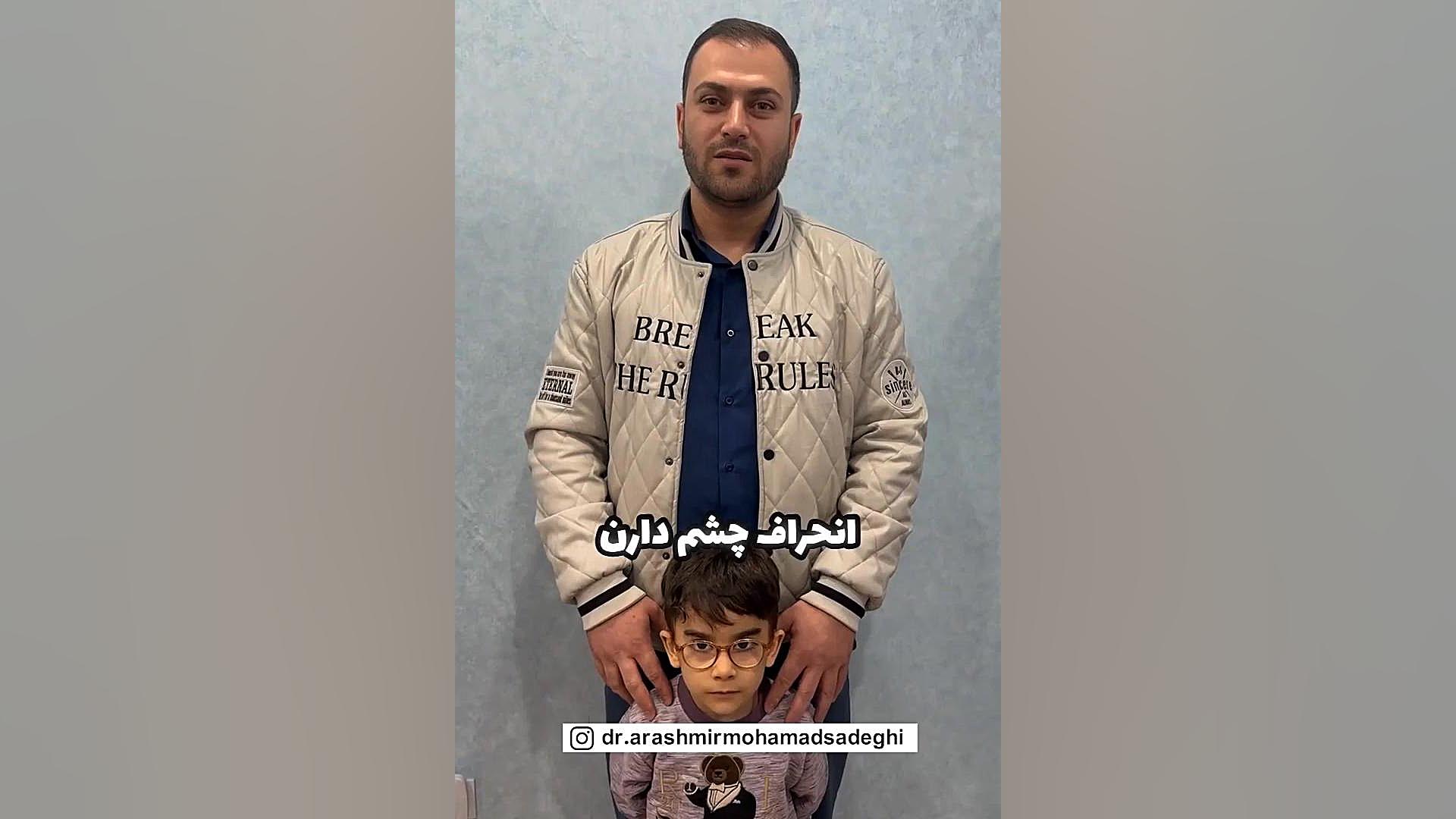 نتیجه جراحی انحراف چشم آزمایش بلوغ ریوی جنین
