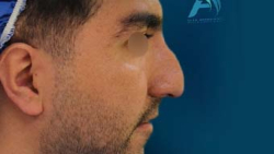 truncate dir-rtl