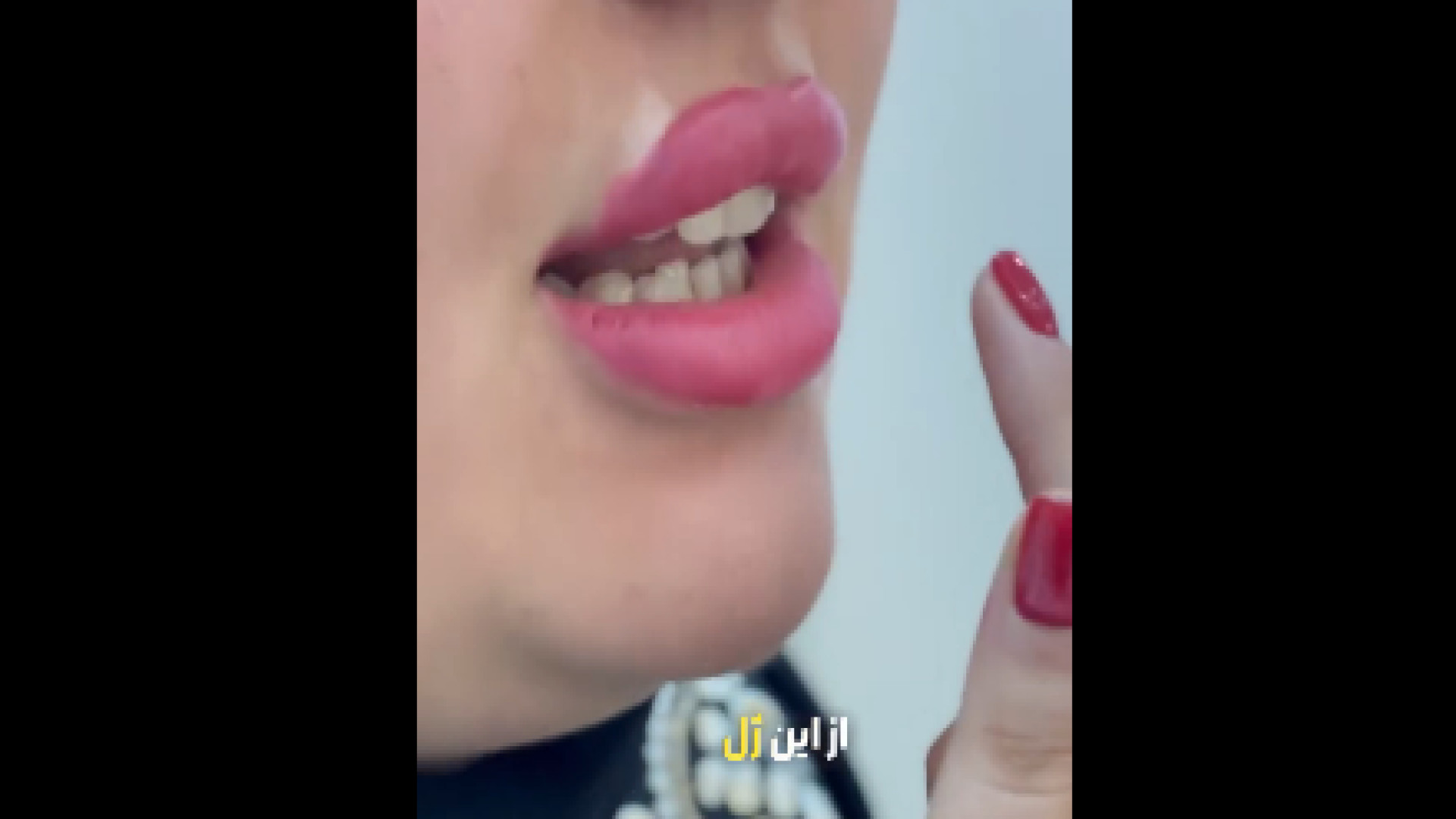 توضیحاتی درمورد تزریق ژل لب دکتر هدی عین اللهی
