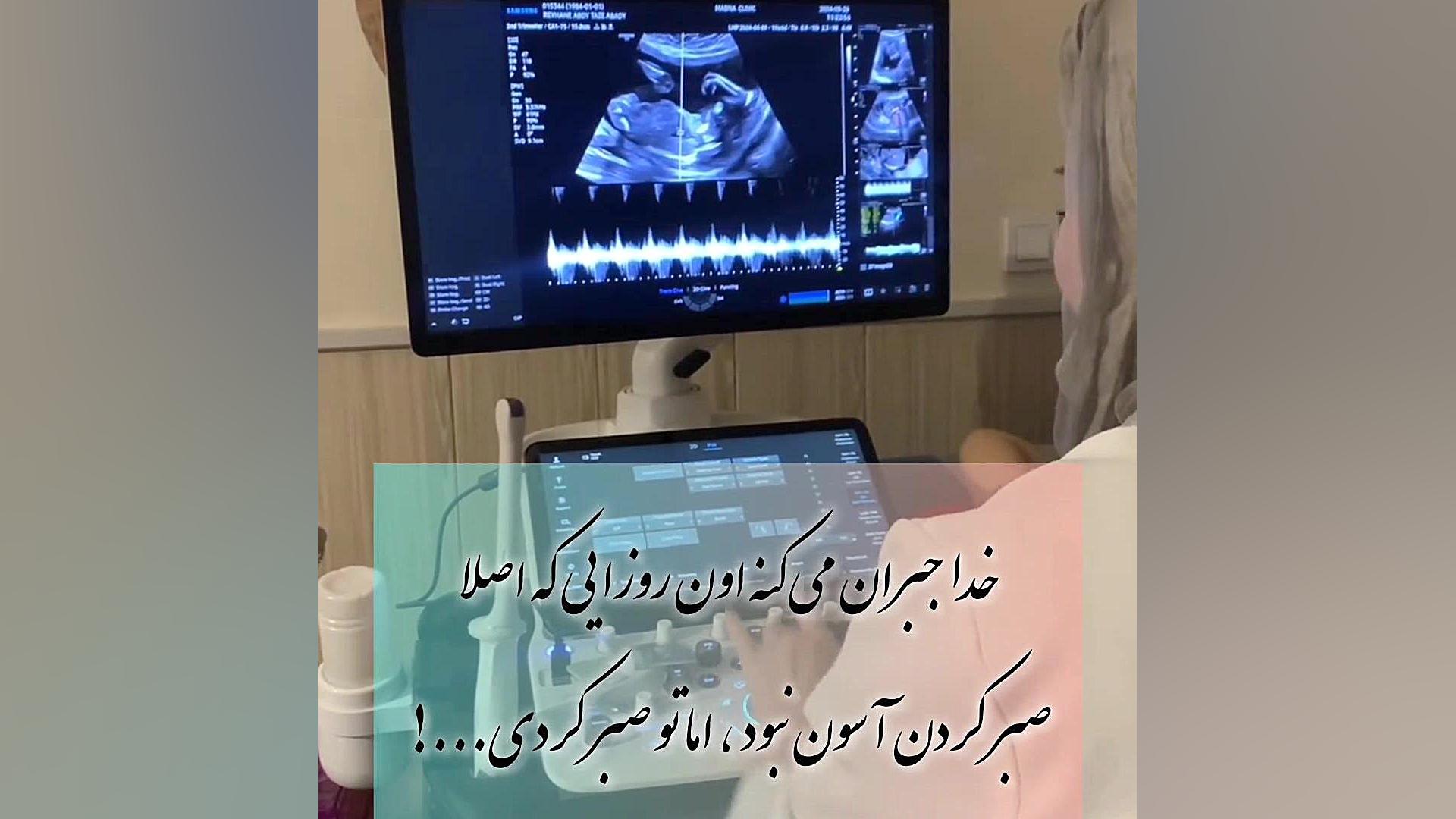 صبر ، صبر و صبر، سونوگرافی مبنا ۰۲۱۲۲۹۱۱۳۷۰ مرکز تصویربرداری دکتر مریم ابراهیمی، مبنا-تهران