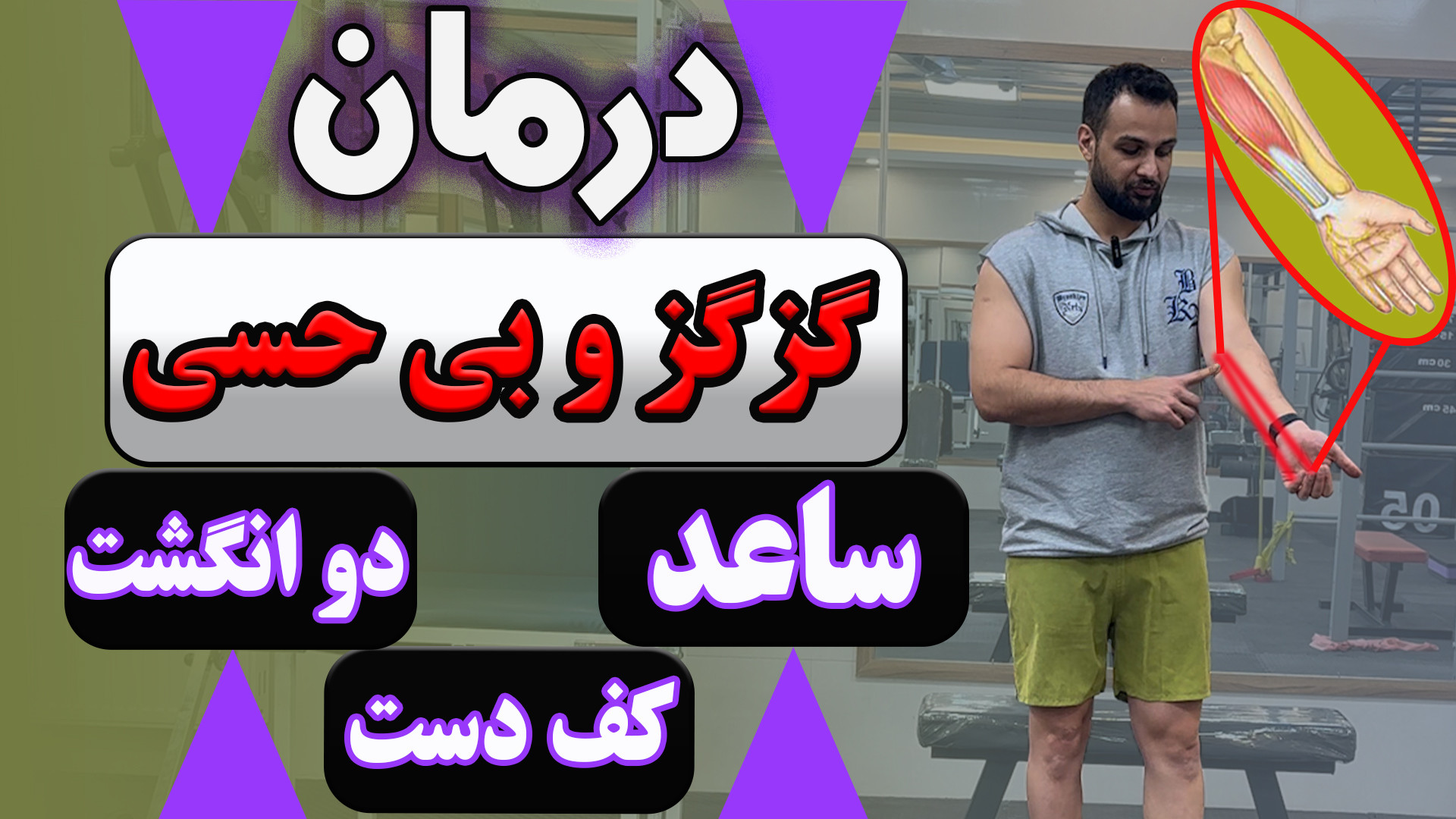 درمان بی حسی و سوزن سوزن شدن دست از آرنج به پایین - ورزش سندرم تونل کوبیتال دست و پا چلفتی