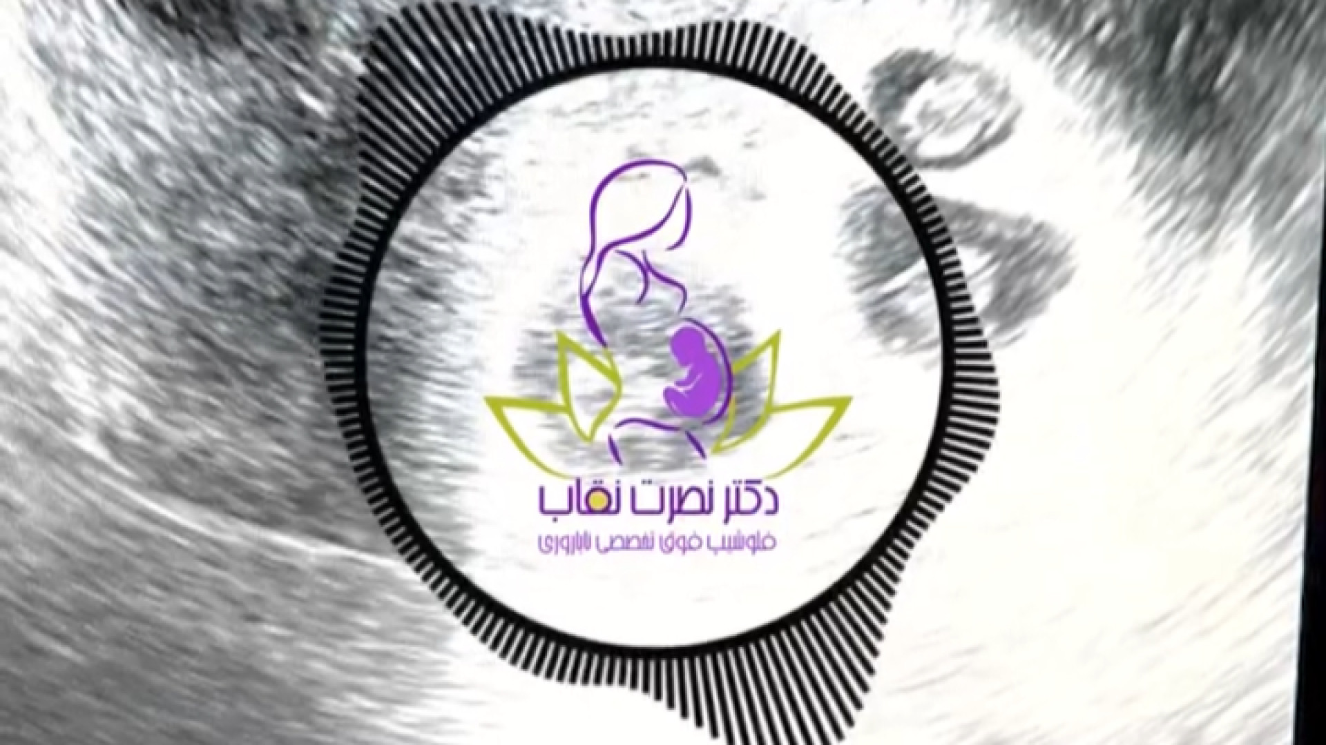 حاملگی در خانمی با سندرم تخمدان پلی کیستیک و ناباروری گوهر خیراندیش
