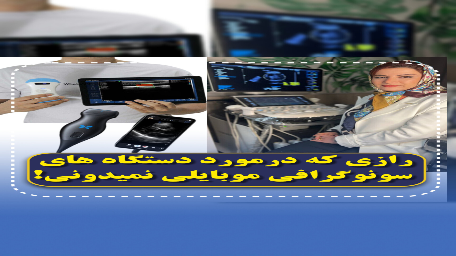 دستگاه های سونوگرافی همراه یا موبایلی دقت کافی دارن یا خیر؟! تزریق ژل