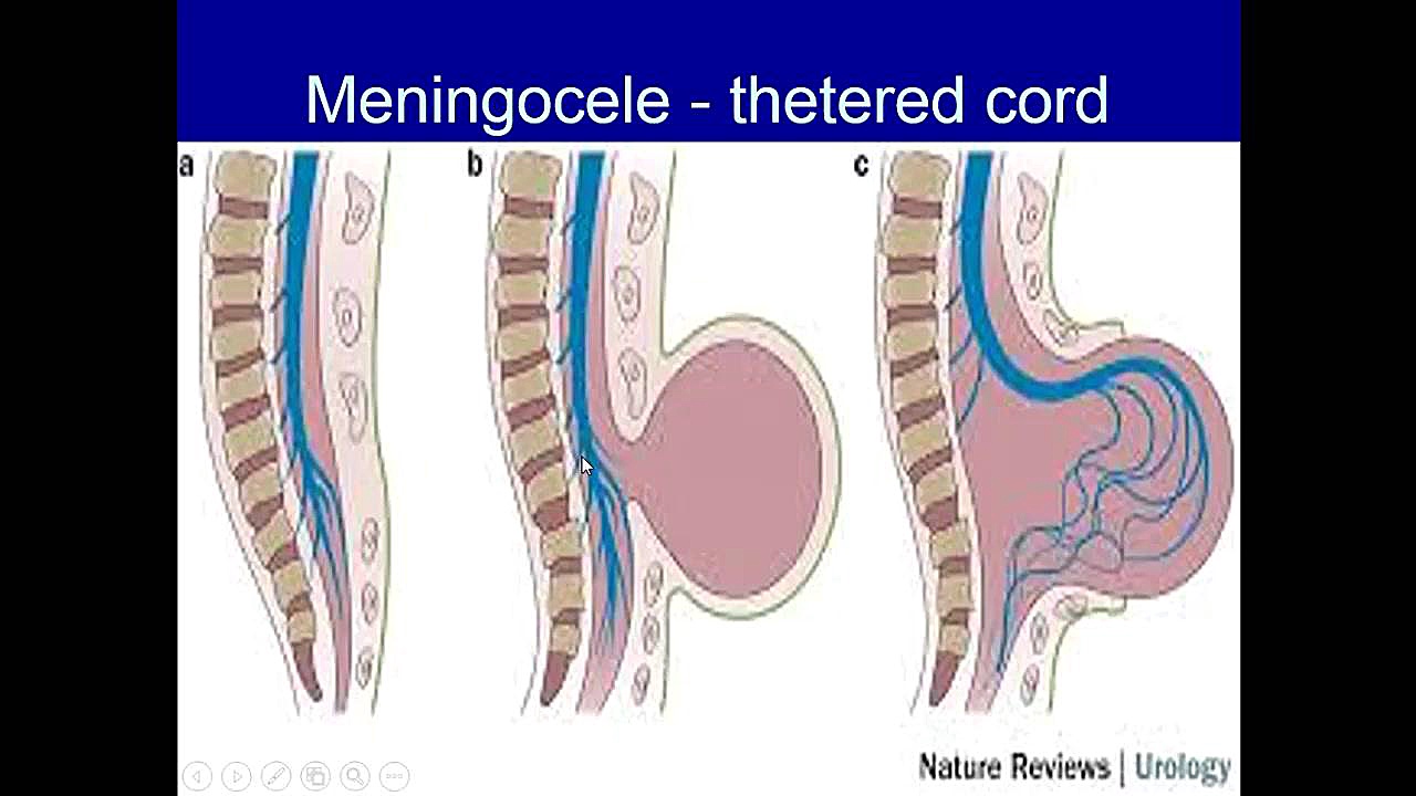 اندیکاسیون و کاربرد بالینیMRI قسمت اول کیهان کلهر