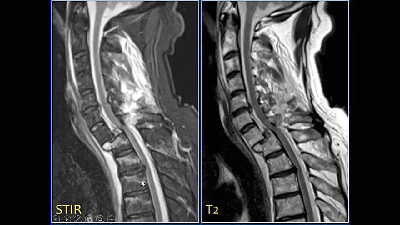 کاربرد بالینی MRI قسمت دوم ریمیکس