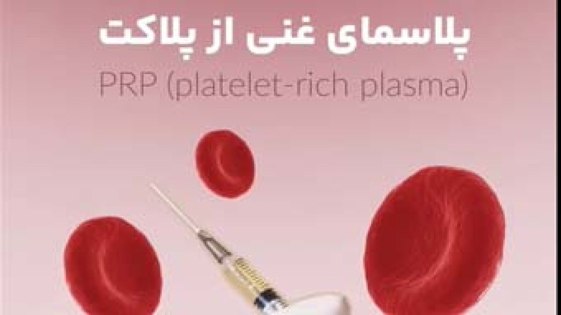 نحوه انجام PRP | دکتر مریم بیکی دکتر مریم بیکی - پوست و مو و زیبایی اراک