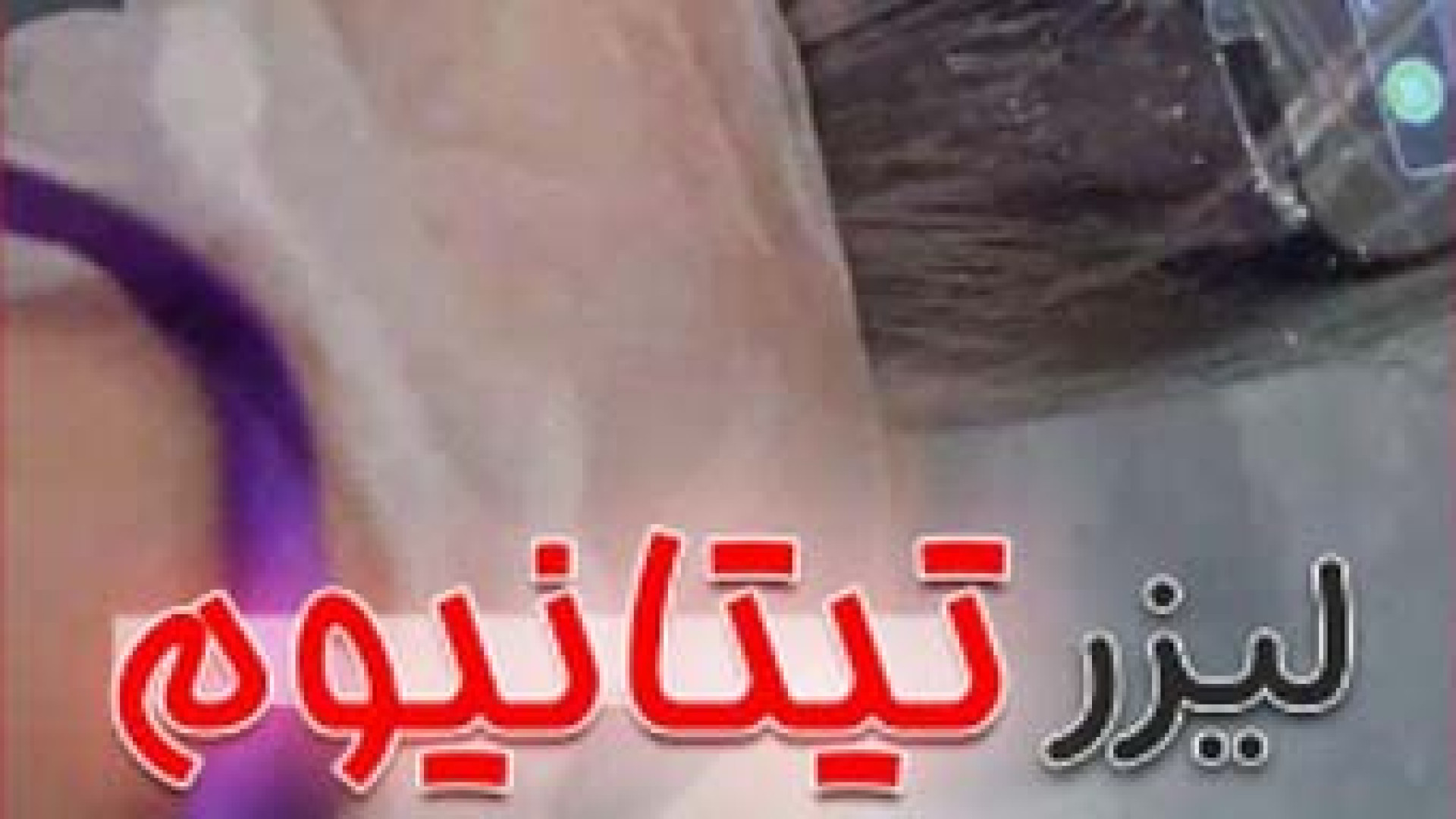 لیزر تیتانیوم | دکتر مریم بیکی دکتر مریم بیکی - پوست و مو و زیبایی اراک