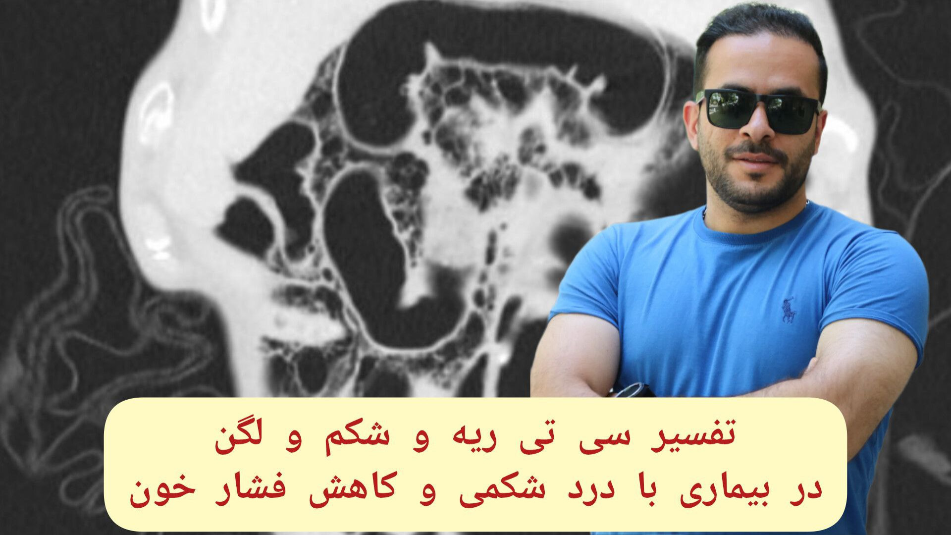 تفسیر سی تی اسکن ریه و شکم و لگن پالپوتومی