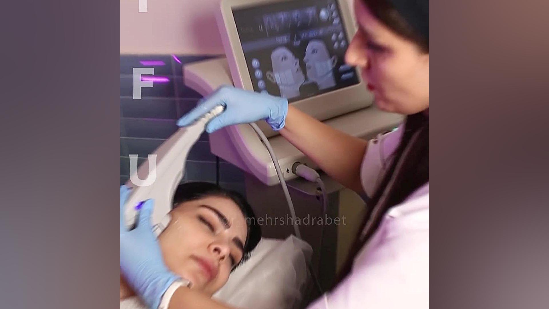 فیلم هایفوتراپی صورت HIFU مزایا کلینیک زیبائی دکتر مهرشاد رابط