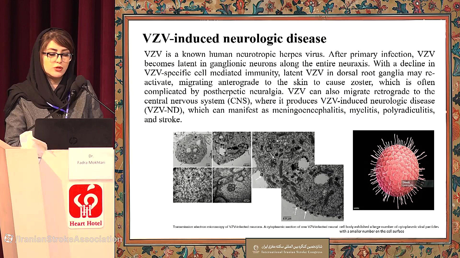 Dr. Fadra Mokhtari -Detection and Prevalence of Varicella... Microarray
