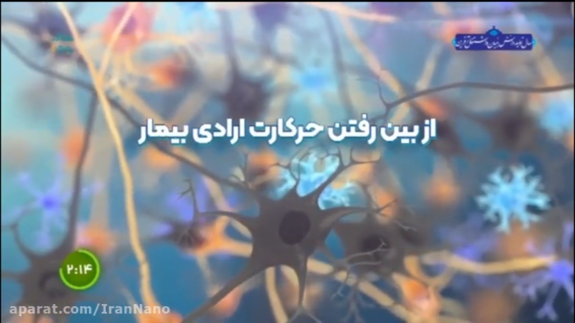 درمان پارکینسون بلیچینگ دندان