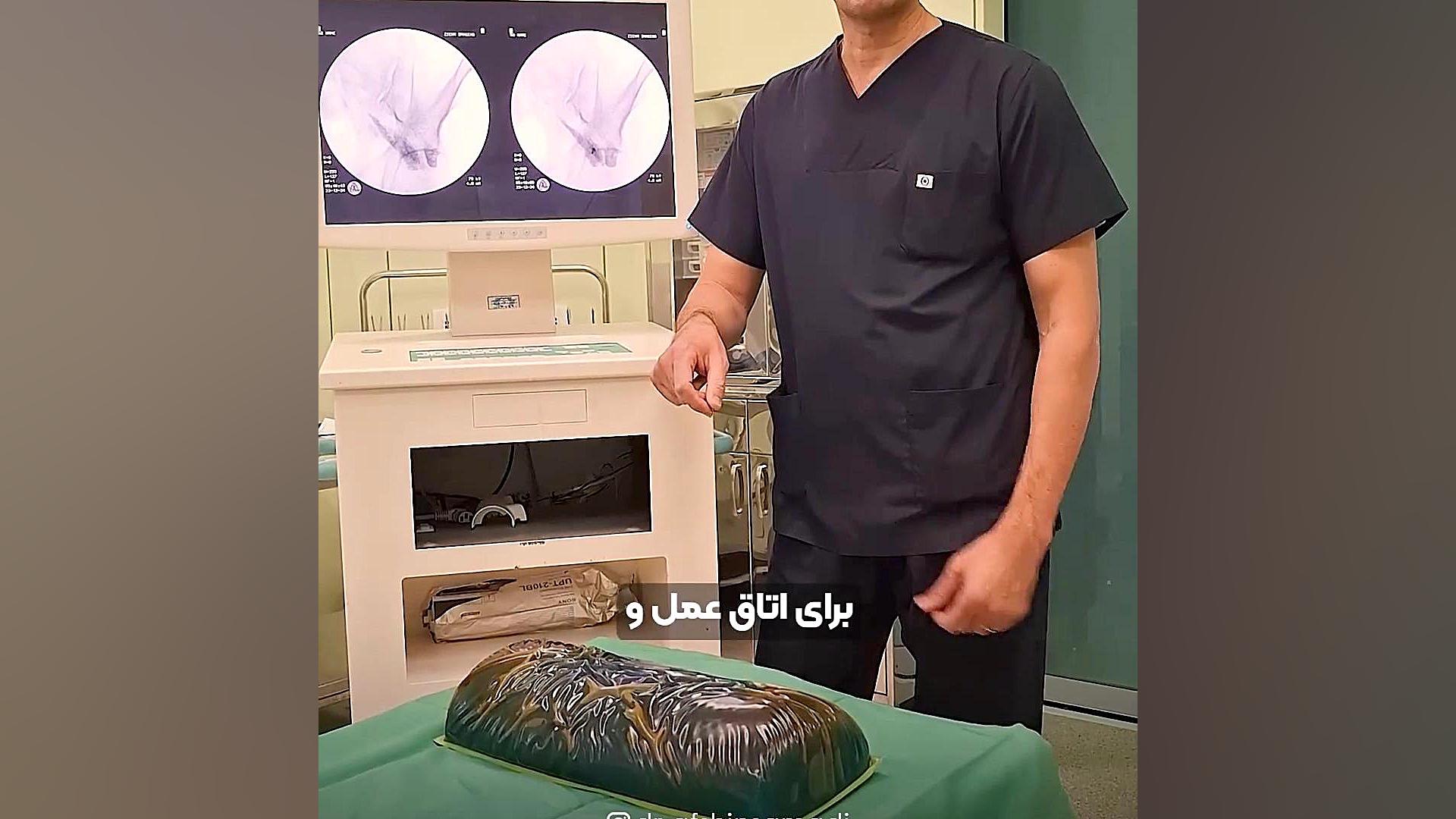 تزریق سندروم پیریفورمیس تحت هدایت دستگاه فلوروسکوپ ارنیزوماب