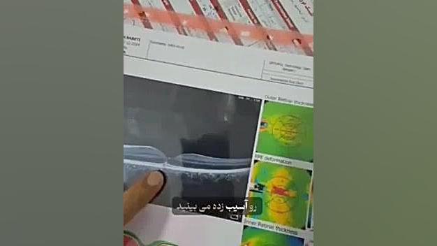 پزشکی پروتز دندان