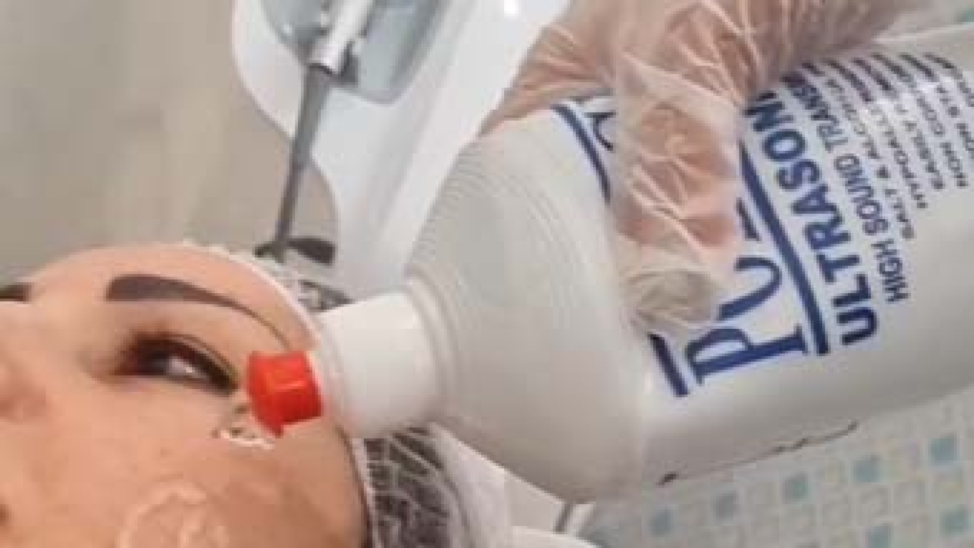 دستگاه هایفوتراپی اولترافورمر | دکتر مریم بیکی دکتر مریم بیکی - پوست و مو و زیبایی اراک