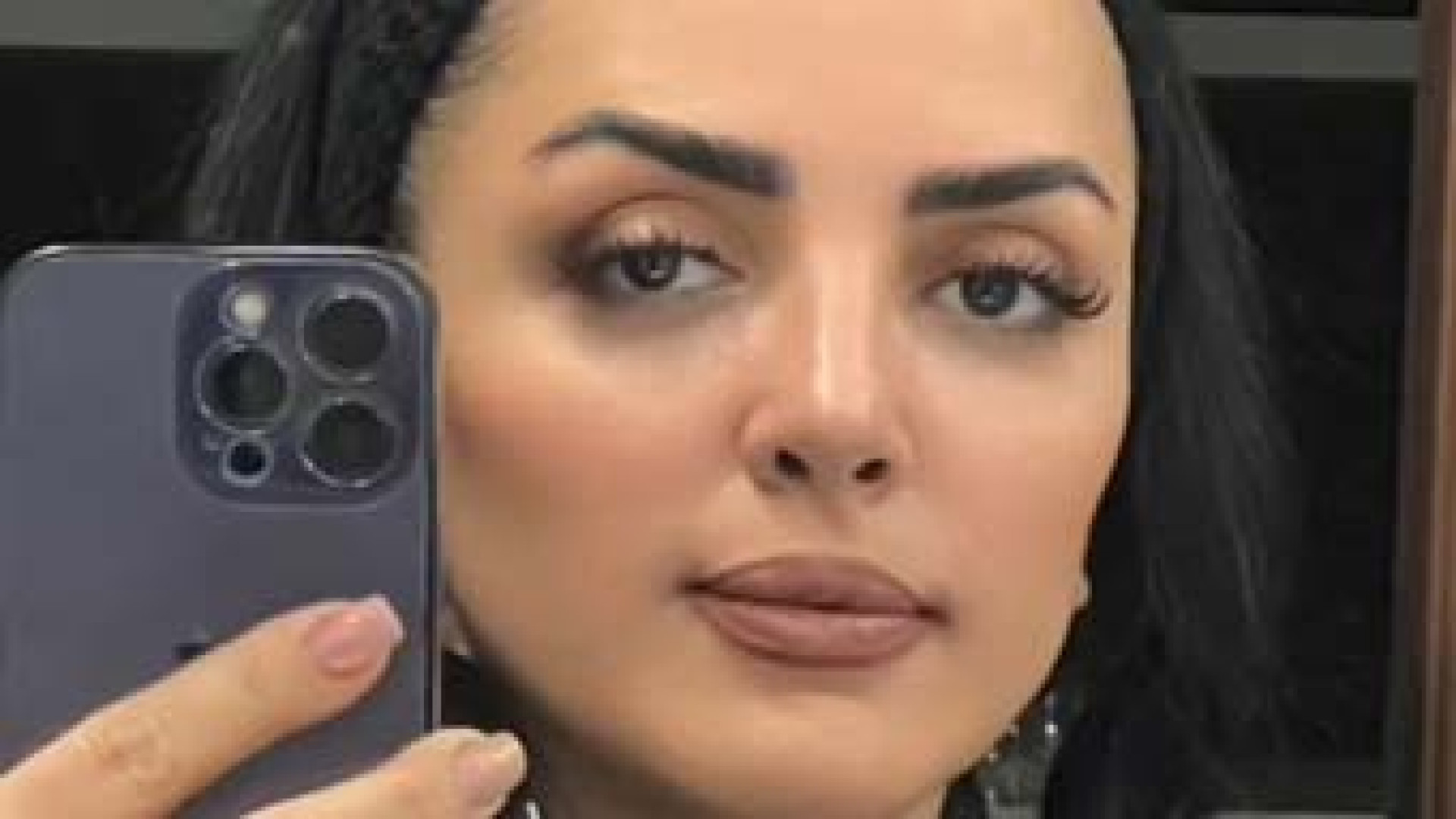 تزریق ژل رِووفیل | دکتر مریم بیکی دکتر مریم بیکی - پوست و مو و زیبایی اراک