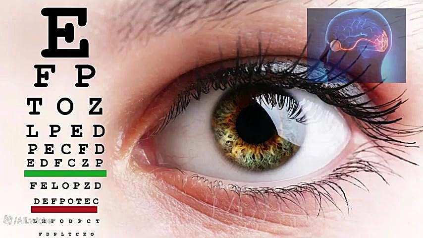 سابلیمینال کاهش نمره چشم-افزایش ۲۰۰درصدی بینایی بلیچینگ