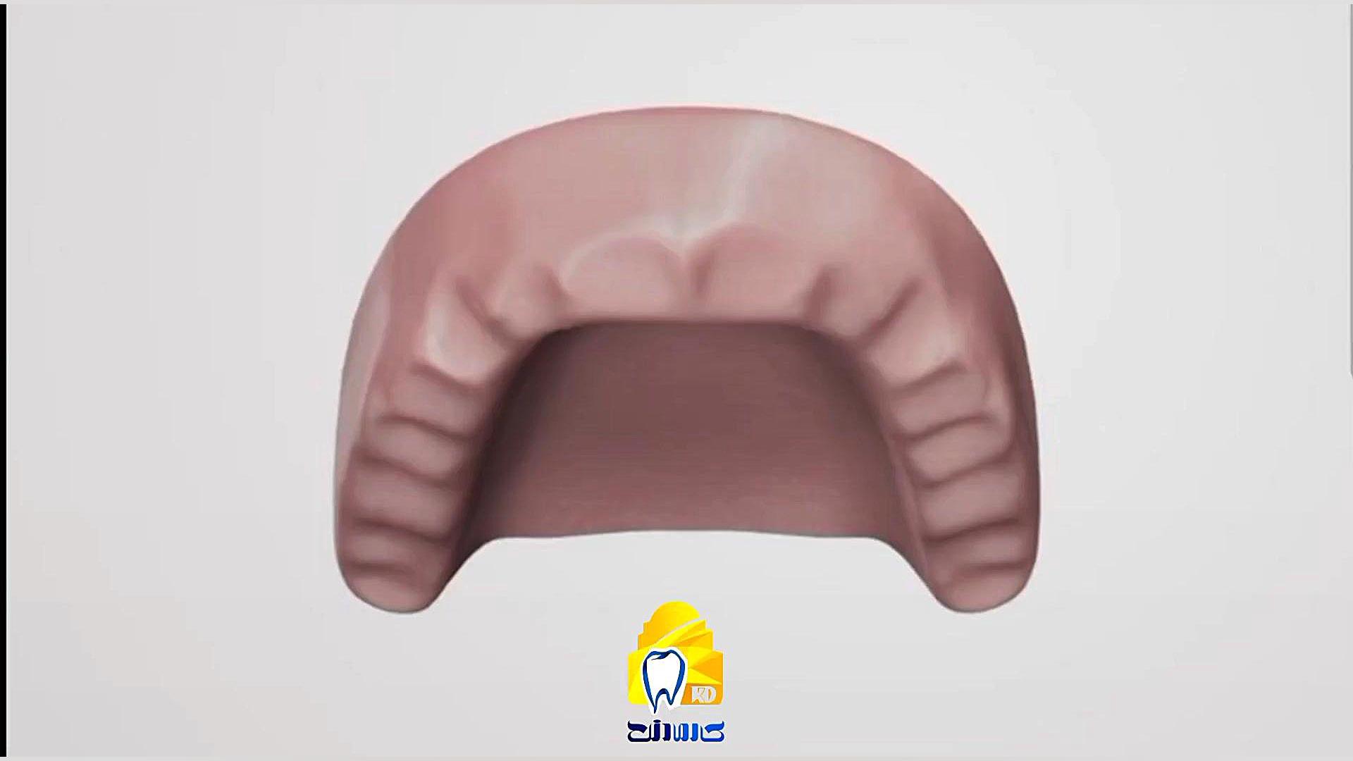 تفاوت روش 4 فیکسچر و روش معمول با 8 فیکسچر برای بازسازی فک بالا کلینیک دندانپزشکی کارمادنت