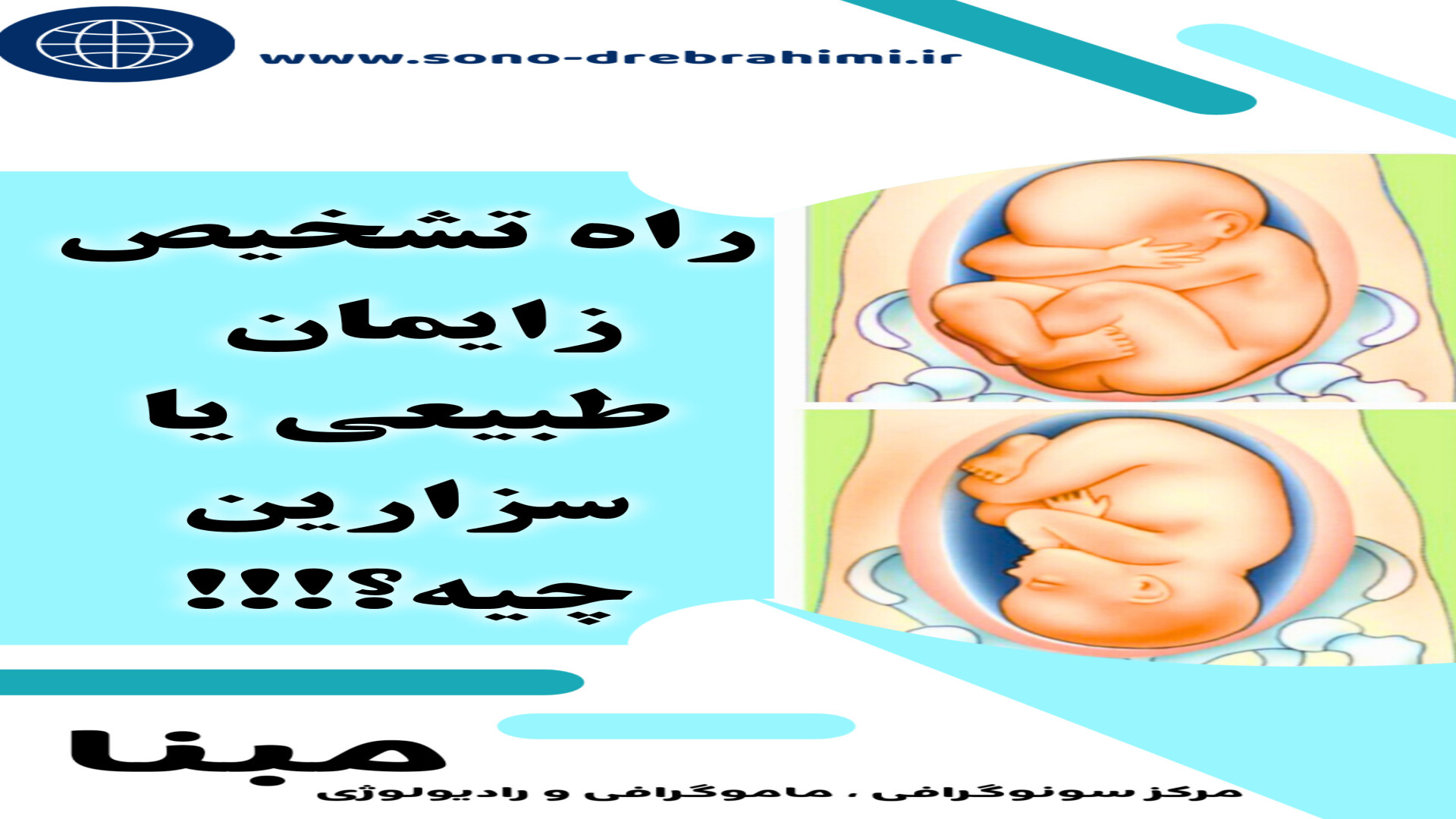 راه تعیین نوع زایمان چیه؟! مرکز سونوگرافی مبنا۰۲۱۲۲۹۱۱۳۷۰ مرکز تصویربرداری دکتر مریم ابراهیمی، مبنا-تهران