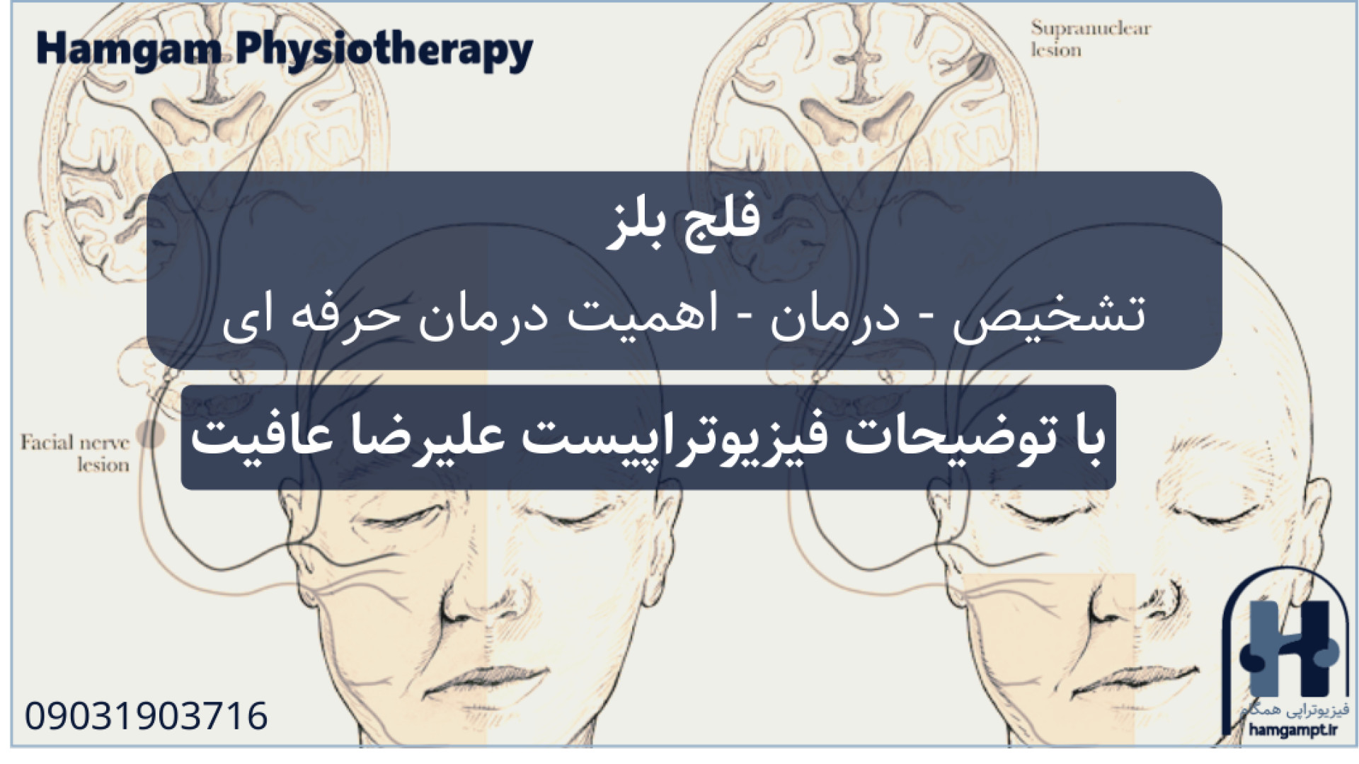 فیزیوتراپی فلج بلز: از کجا بفهمیم چه روشی مؤثر است؟ دندان شیری