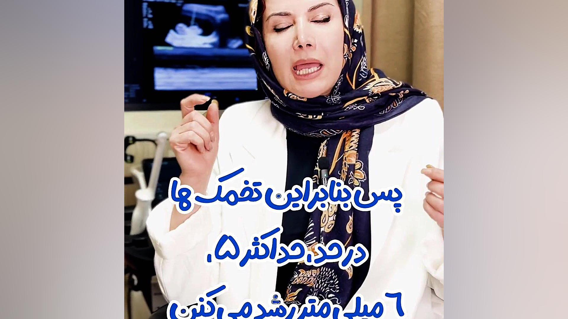 تخمدان پلی کیستیک یا تنبلی تخمدان! سونوگرافی مبنا ۰۲۱۲۲۹۱۱۳۷۰ اکستنشن تاج دندان