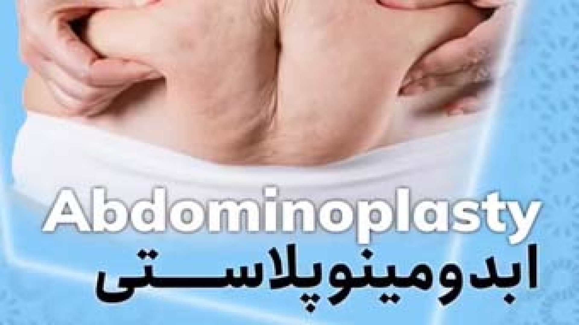 ابدومینوپلاستی | دکتر احمدی دهج دکتر آیدین احمدی دهج | جراح پلاستیک