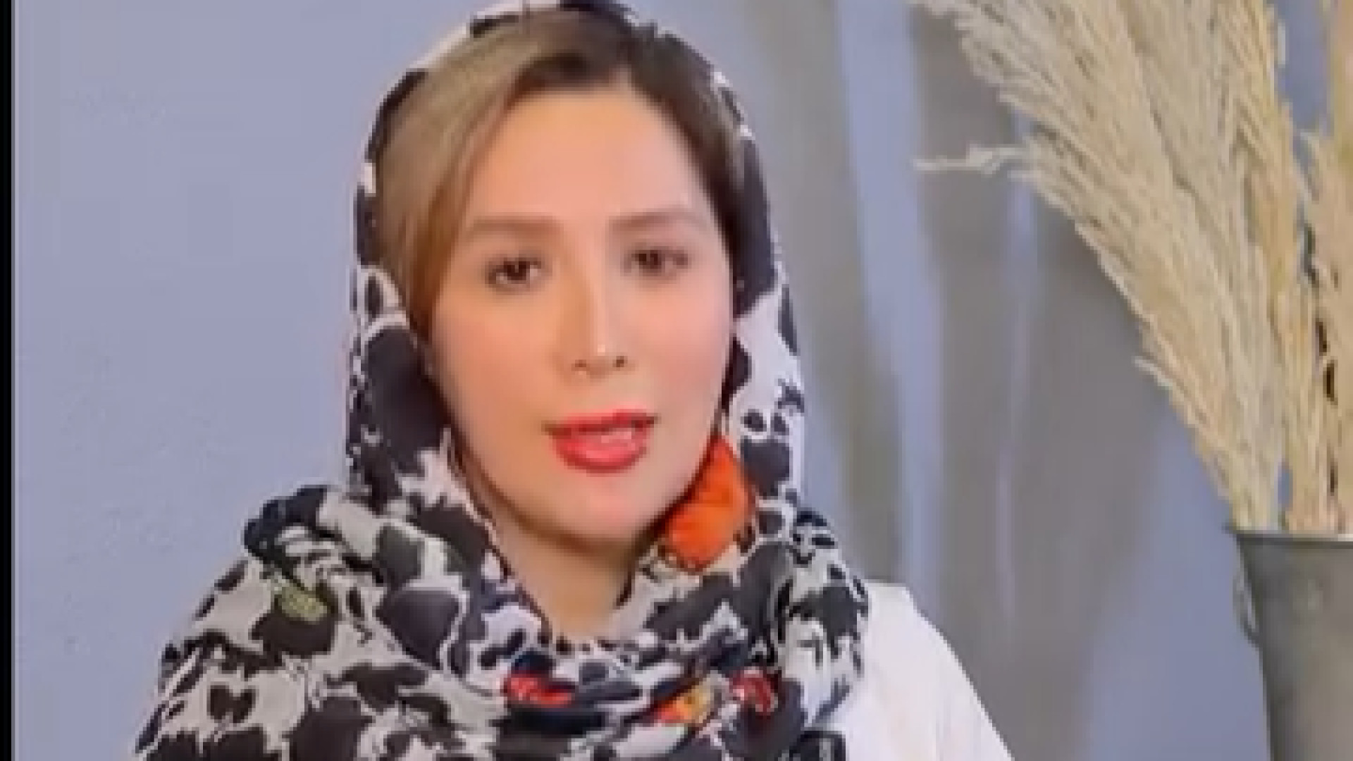 رفع لبخند لثه ای با بوتاکس دکتر بهناز همدانی - متخصص پوست، مو و زیبایی