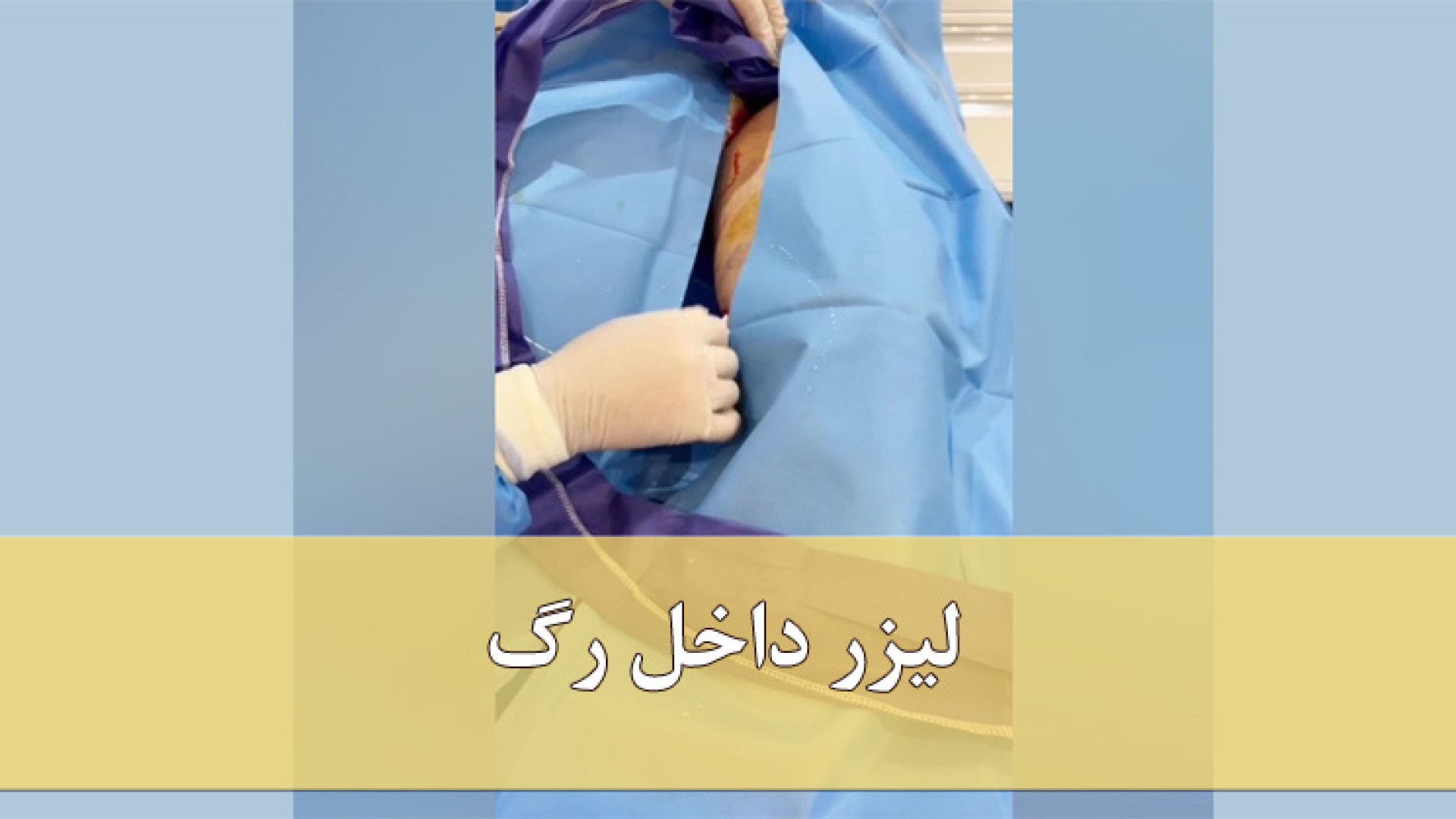 لیزر داخل رگ دکتر مهدی کریمی