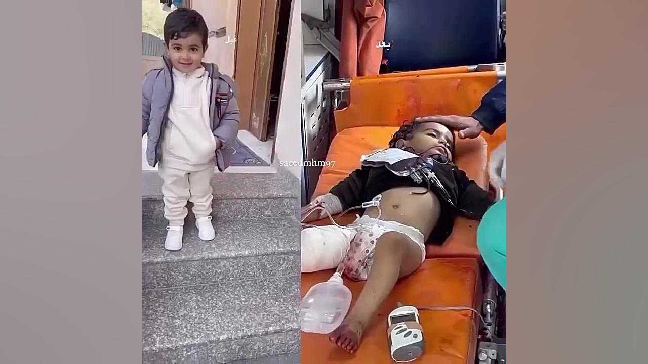 آمار شهدای غزه به ۴۶ هزار و ۵۳۷ نفر افزایش یافت کلینیک مو