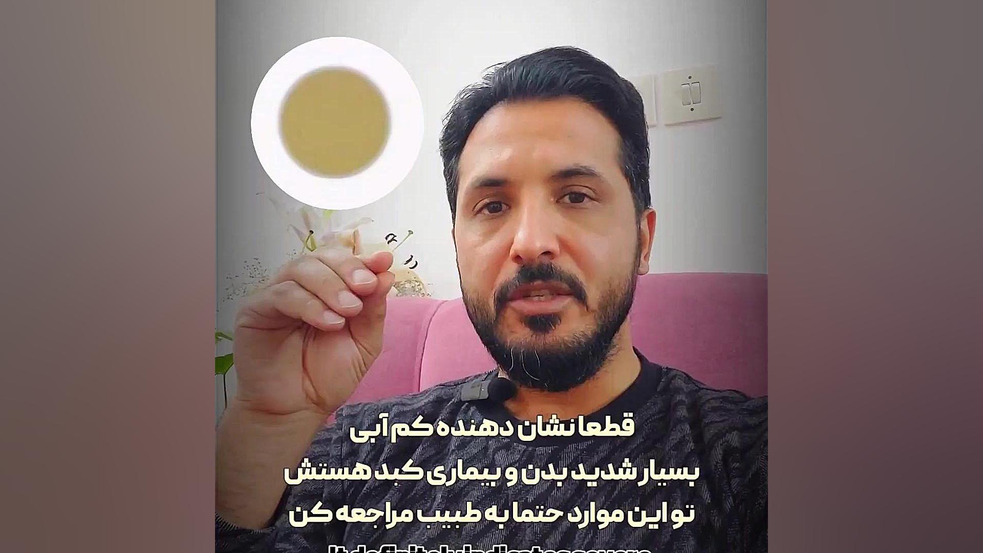 ادرار شناسی حرفه ای ۲ علائم بیماری کلیه رفع غبغب