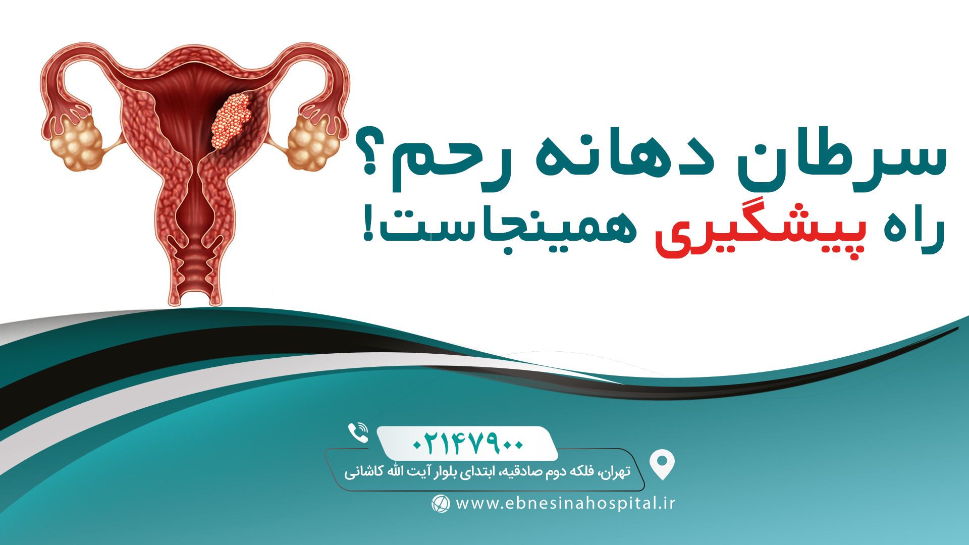 پیشگیری از سرطان دهانه رحم با انجام یک غربالگری ساده