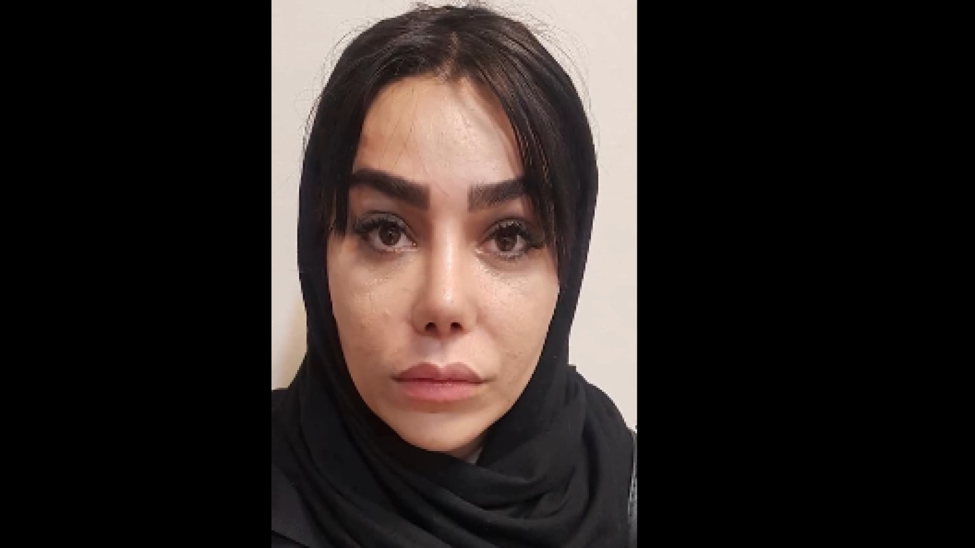 لیفت پیشانی و عمل بینی دکتر محمودرضا اصحاب یمین - فوق تخصص پلاستیک