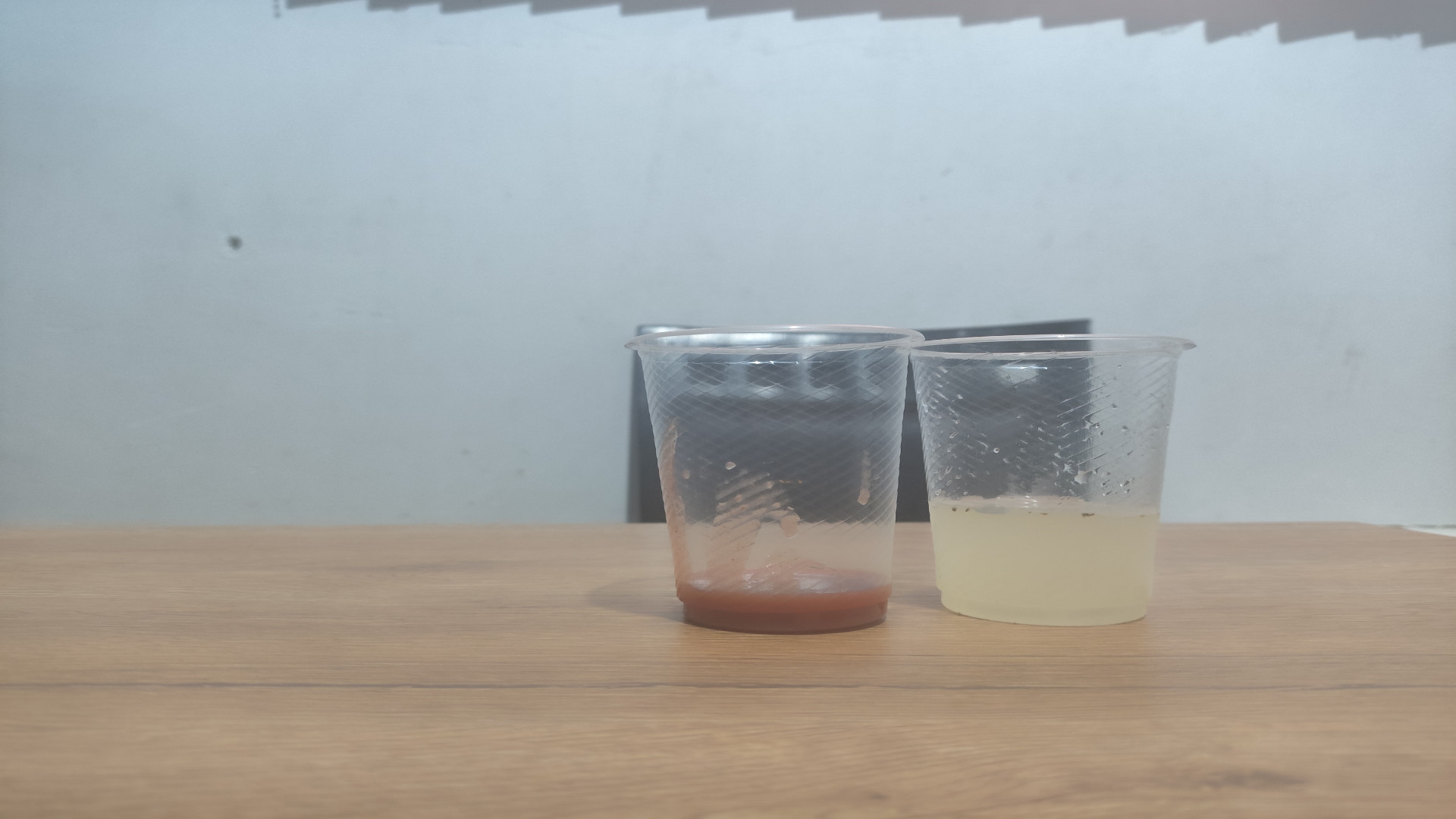 استفراغ کردم؟؟؟ ارتودنسی