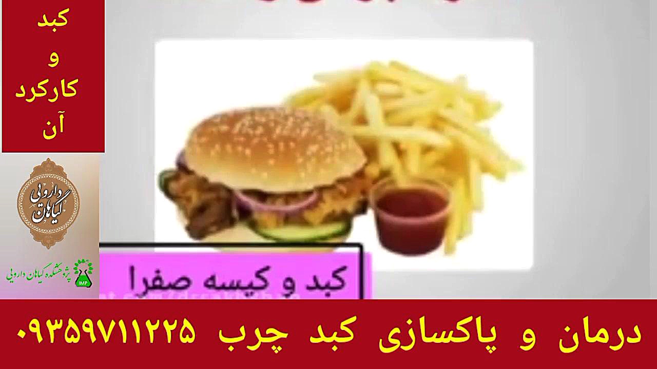 کارکرد کبد در بدن درمان و پاکسازی کبدچرب ۰۹۳۵۹۷۱۱۲۲۵ اندودنتیکس
